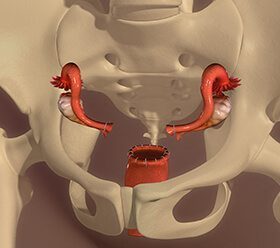 Vaginal Hysterectomy Surgery